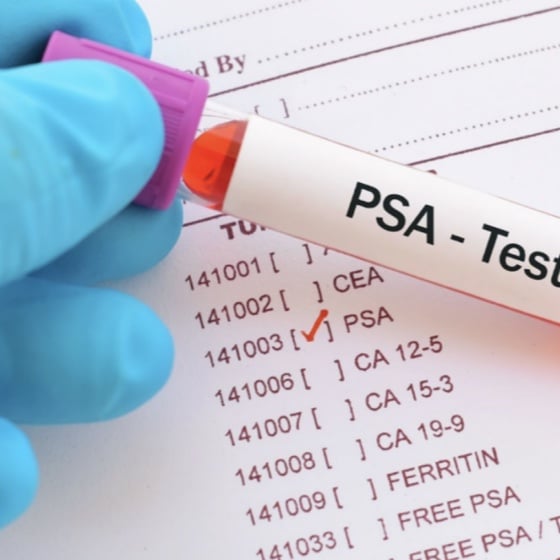PSA and alkaline phosphatase