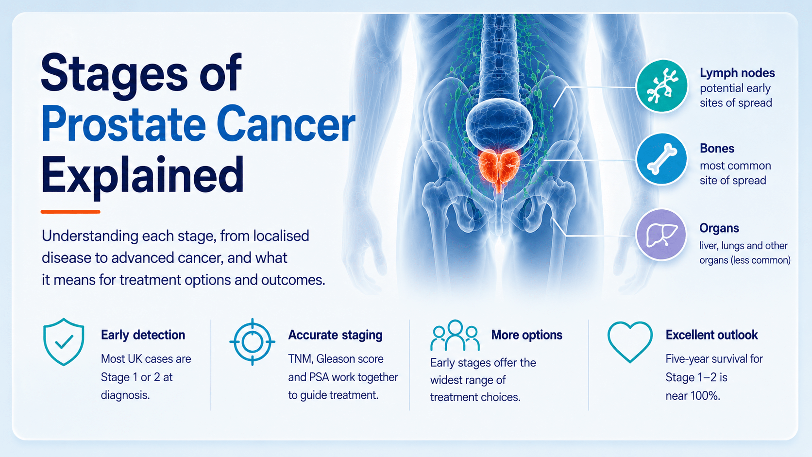 Protate Pattern 4 Stages of Prostate Cancer Explained