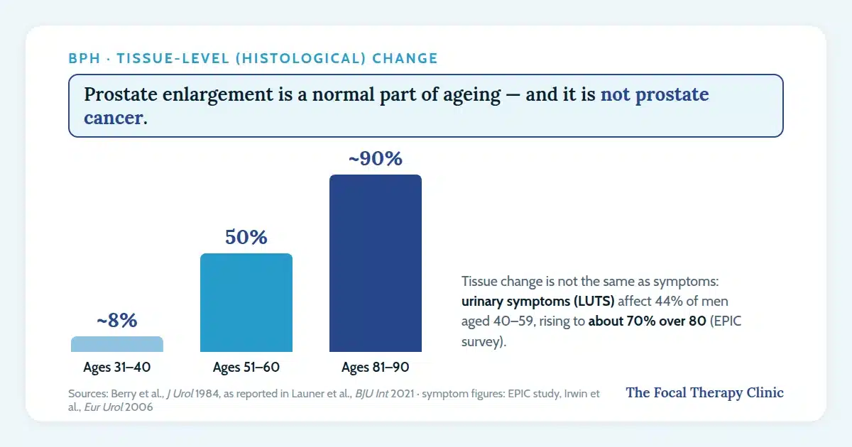 Chart showing prostate tissue enlargement rises from 8% of men in their 30s to around 90% of men in their 80s