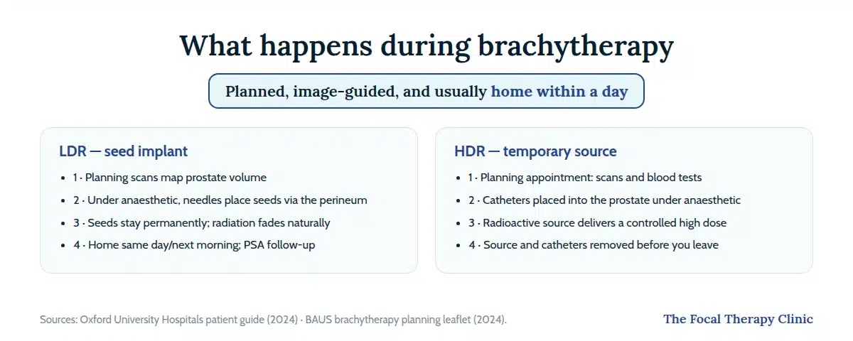 Step-by-step brachytherapy procedures: LDR seed implant in four steps and HDR temporary source in four steps