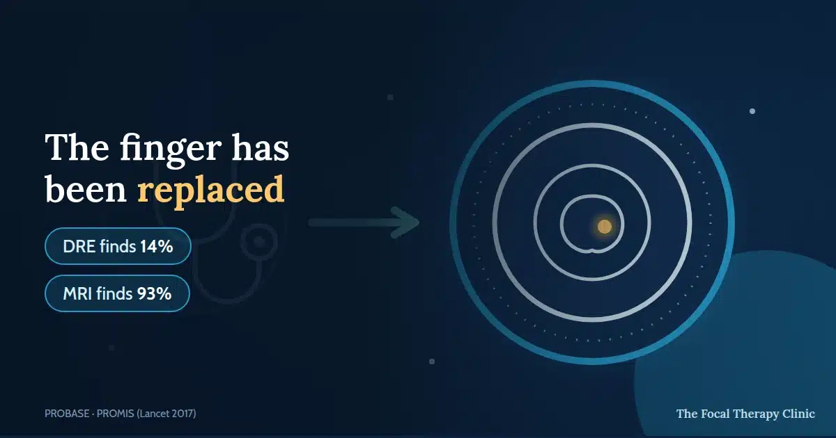 The finger has been replaced — DRE finds 14%, MRI finds 93%