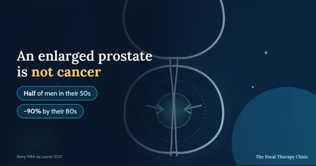 An enlarged prostate is not cancer — half of men in their 50s, around 90% by their 80s