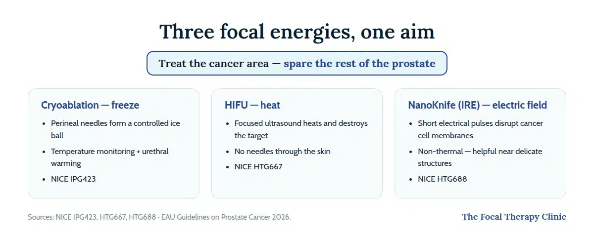 Three focal therapy energies compared: cryoablation freezes (NICE IPG423), HIFU heats (NICE HTG667), NanoKnife IRE uses electrical pulses (NICE HTG688)