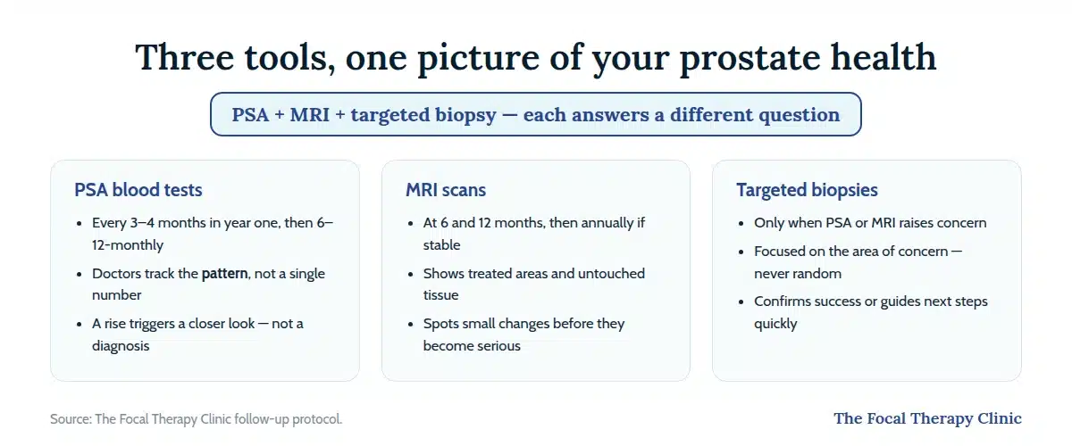 Three monitoring tools after focal therapy: PSA blood tests track the pattern, MRI scans spot small changes, targeted biopsies confirm findings only when needed