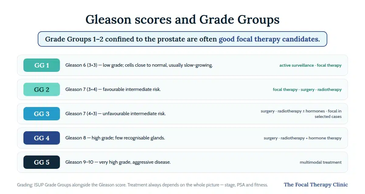 Gleason score and Grade Group guide from GG1 (Gleason 6) to GG5 (Gleason 9–10) with typical treatment options