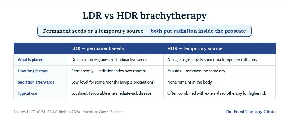 Table comparing LDR and HDR brachytherapy: what is placed, how long it stays, radiation afterwards, and typical use