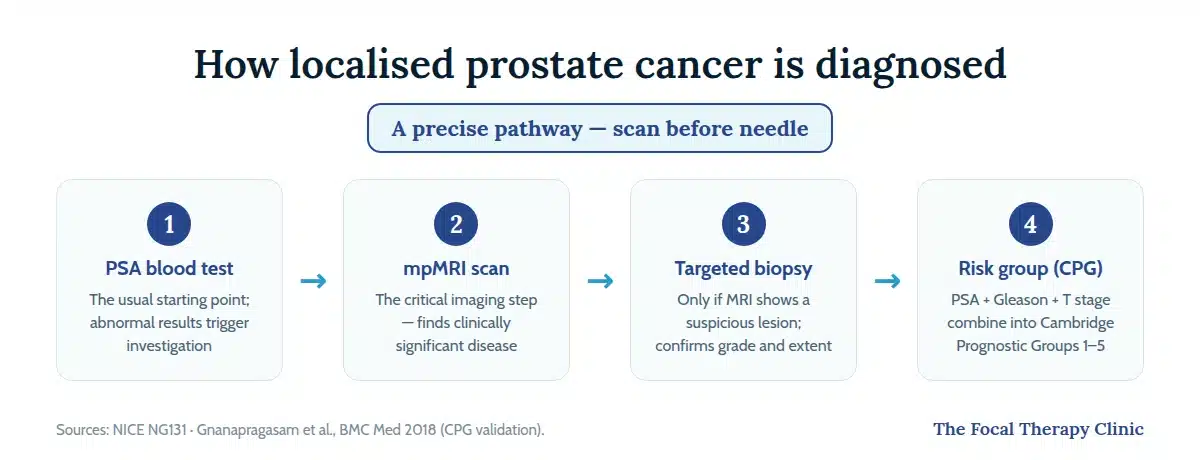 How localised prostate cancer is diagnosed: PSA blood test, mpMRI scan, targeted biopsy only if MRI shows a lesion, then risk grouping with the Cambridge Prognostic Groups