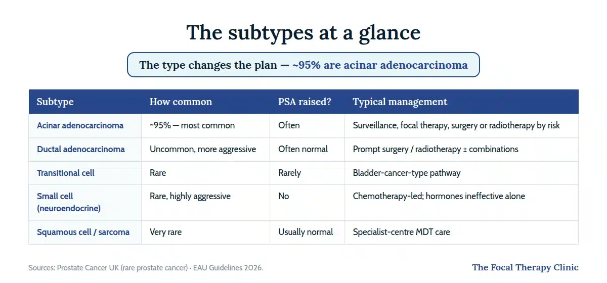 Table of prostate cancer subtypes: acinar adenocarcinoma about 95%, ductal adenocarcinoma, transitional cell, small cell neuroendocrine, and squamous cell or sarcoma — prevalence, PSA behaviour and management