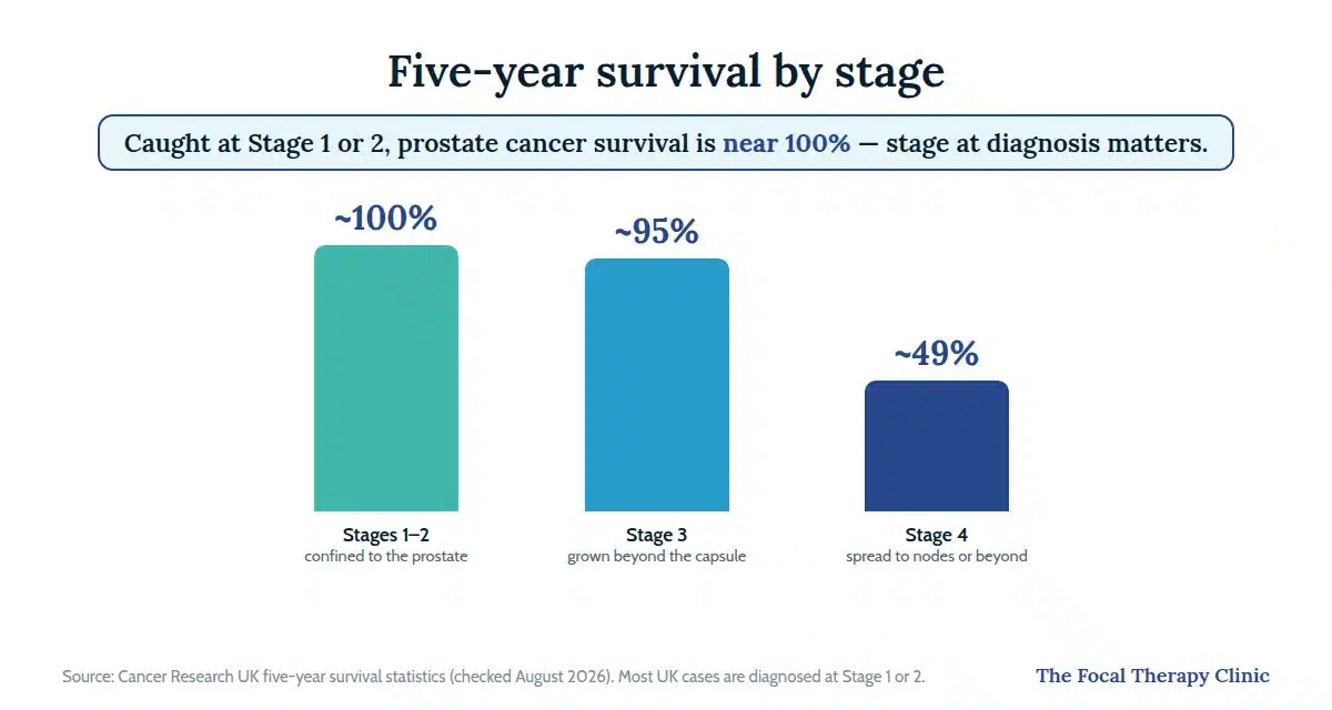 Chart: five-year prostate cancer survival near 100% for stages 1–2, about 95% for stage 3 and about 49% for stage 4