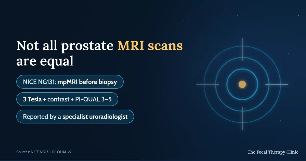 Not all prostate MRI scans are equal: NICE NG131 recommends mpMRI before biopsy, look for 3 Tesla with contrast and PI-QUAL 3-5, reported by a specialist uroradiologist