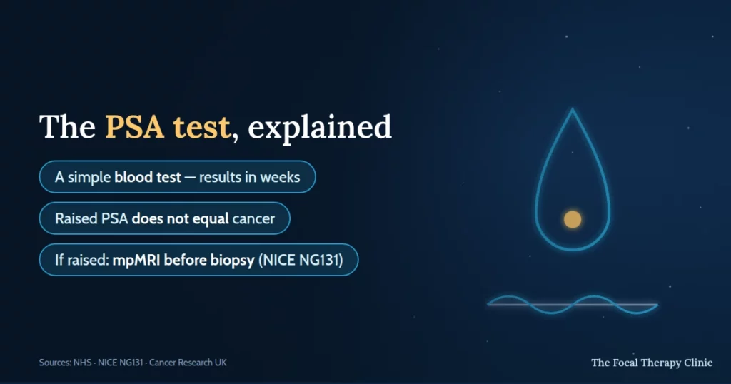 The PSA test explained: a simple blood test with results in weeks, a raised PSA does not equal cancer, and if raised the next step is mpMRI before biopsy under NICE NG131