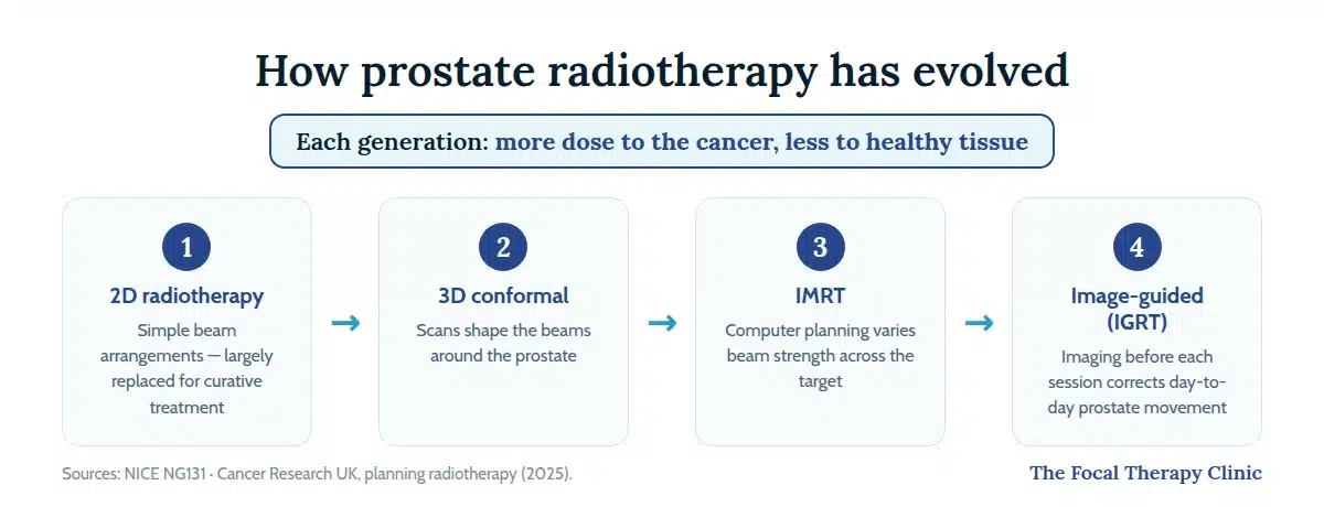 Four-step evolution of prostate radiotherapy: 2D methods, 3D conformal, IMRT computer-planned dose shaping, then image-guided IGRT