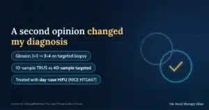 A second opinion changed my diagnosis: Gleason 3+3 became 3+4 on a 40-sample targeted biopsy after a 10-sample TRUS biopsy under-staged it, treated with day-case HIFU under NICE HTG667