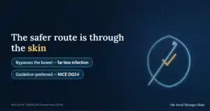 The safer route is through the skin — bypasses the bowel, far less infection; guideline-preferred, NICE DG54