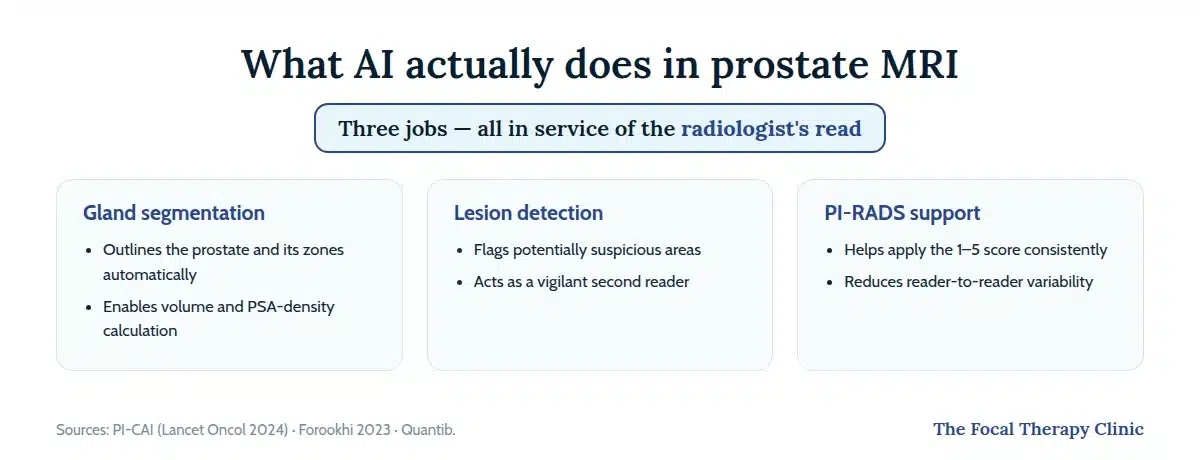 Three functions of AI in prostate MRI: gland segmentation for volume and PSA density, lesion detection as a second reader, and PI-RADS scoring support