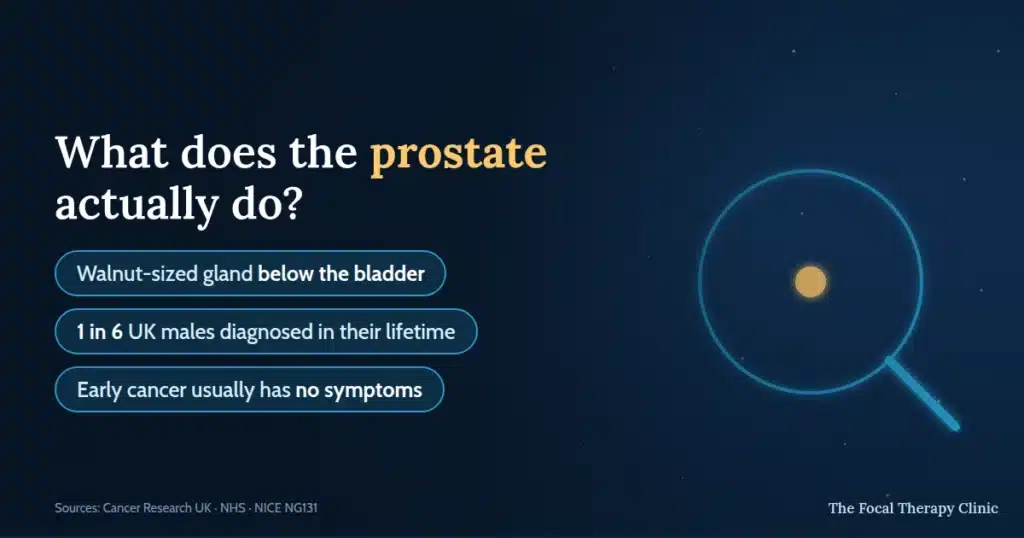 What does the prostate actually do? A walnut-sized gland below the bladder; 1 in 6 UK males are diagnosed with prostate cancer in their lifetime and early cancer usually has no symptoms