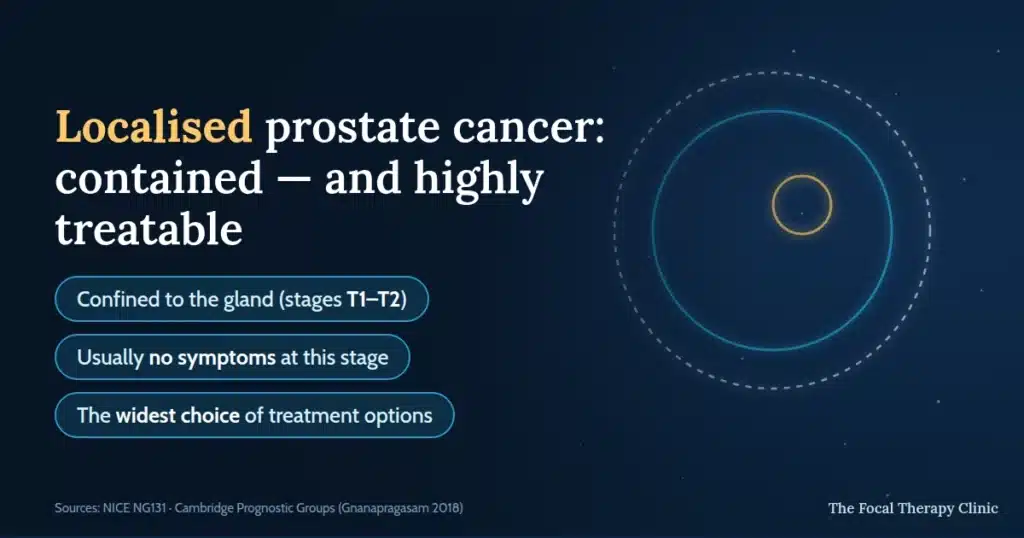 Localised prostate cancer: contained and highly treatable — confined to the gland at stages T1–T2, usually no symptoms at this stage, and the widest choice of treatment options