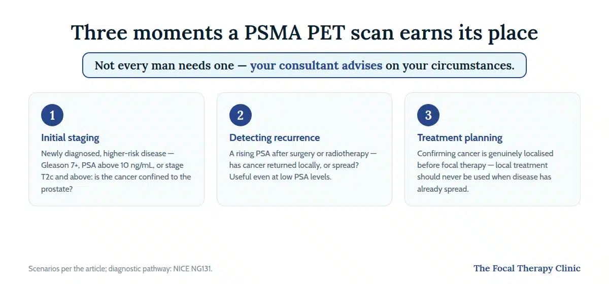 Three scenarios for a PSMA PET scan: initial staging of higher-risk cancer, detecting recurrence, and treatment planning